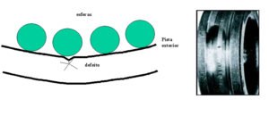 Figura 5 - Etapa 3 de la insuficiencia de cojinete - Los aumentos Gap