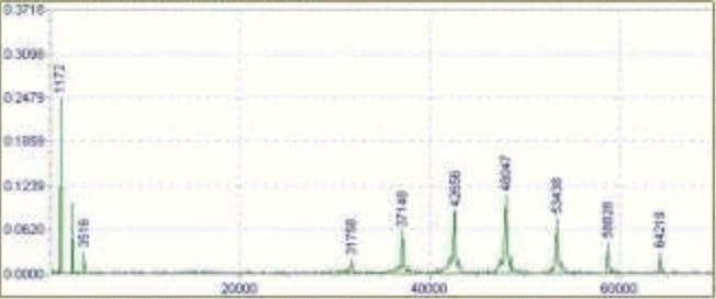 limitaciones del espectro FFT